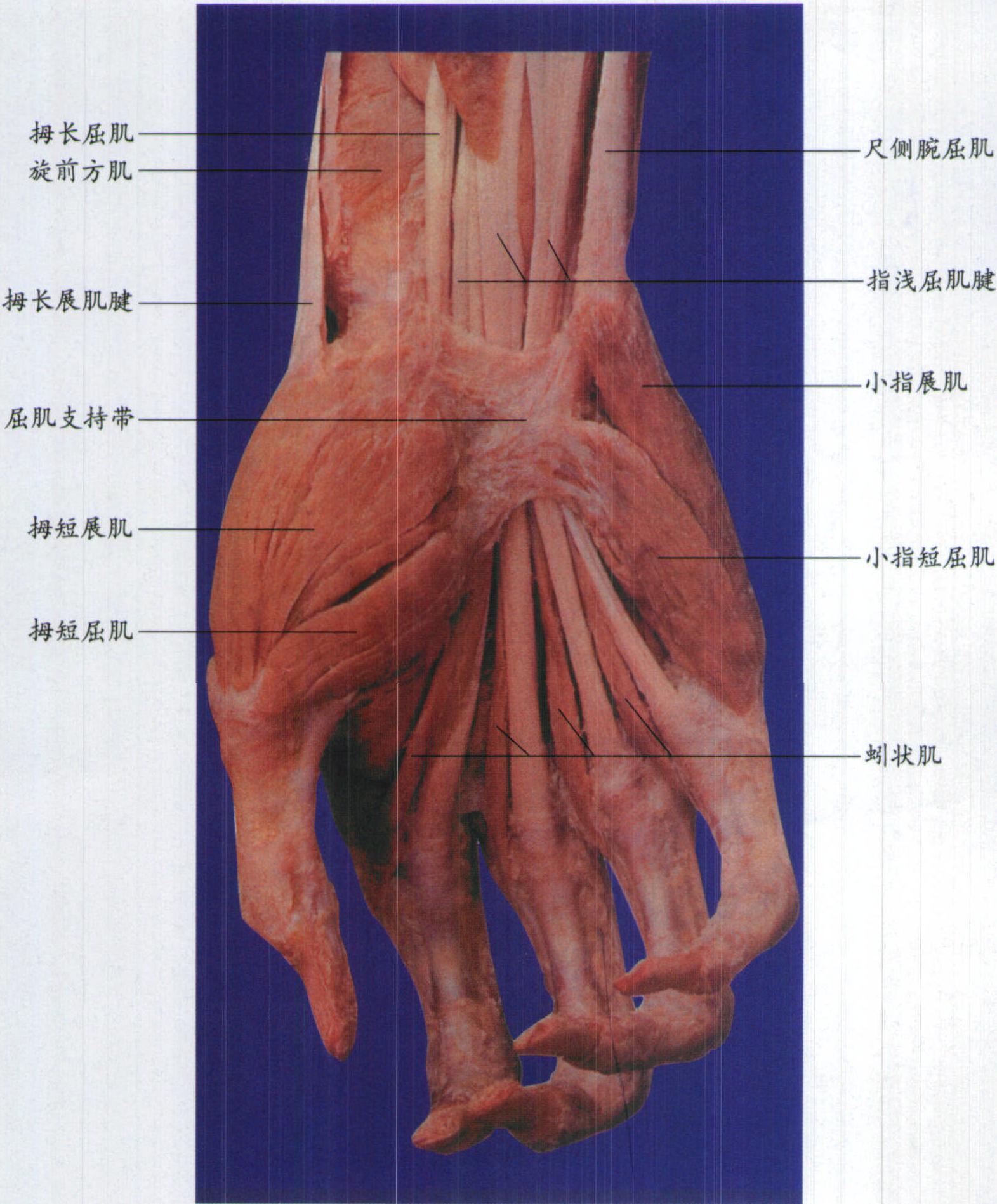 图7-24 手掌的肌肉、血管和神经(四)-临床解剖学-医学